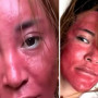 22 жыл бойы макияжын жумаған әйел ауруға душар болды