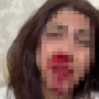 Алматыда балаларының көзінше бұрынғы әйелінің жағын сындырған күдікті ұсталды