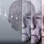 Альцгеймермен ауыратын адамның миынан “митохондриялық түйін” анықталды