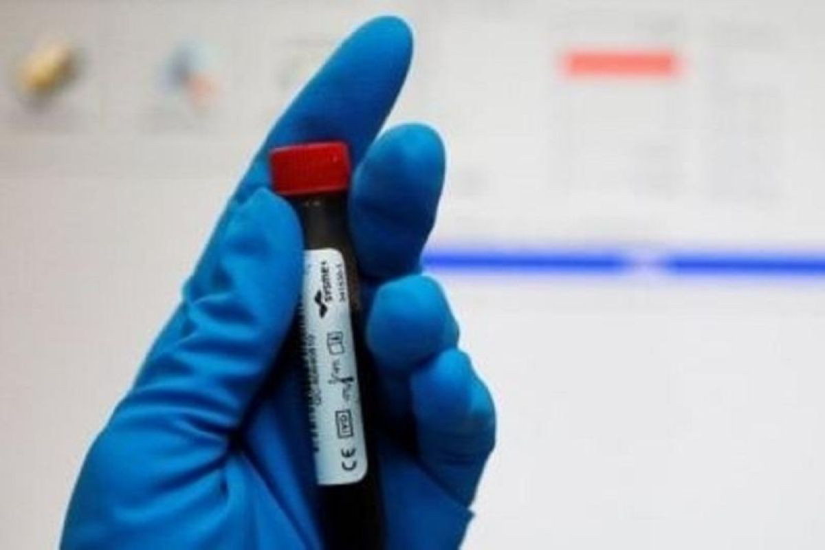 Дүниежүзілік допингке қарсы агенттік Алматыдағы зертхана жұмысын тоқтатты