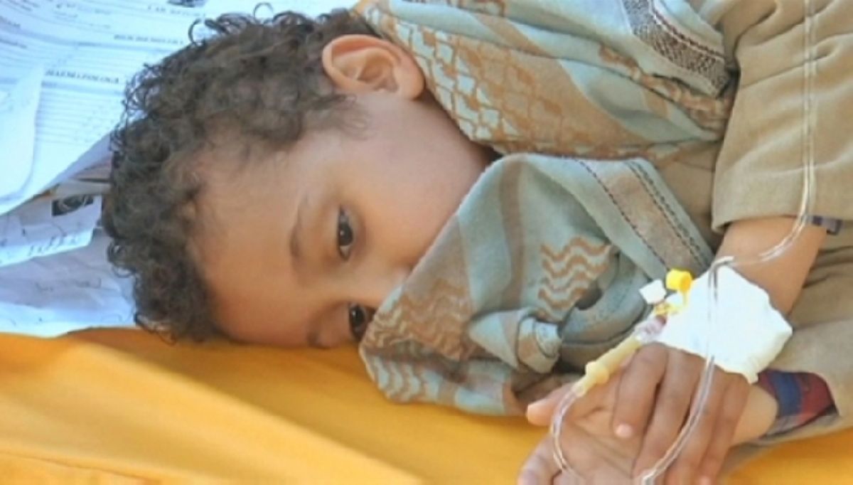 Йеменде тырысқаққа шалдыққандар саны 300 мыңнан асуы мүмкін