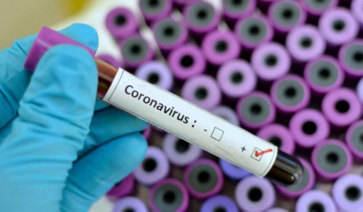 Италиядан оралған ресейліктен коронавирус анықталды