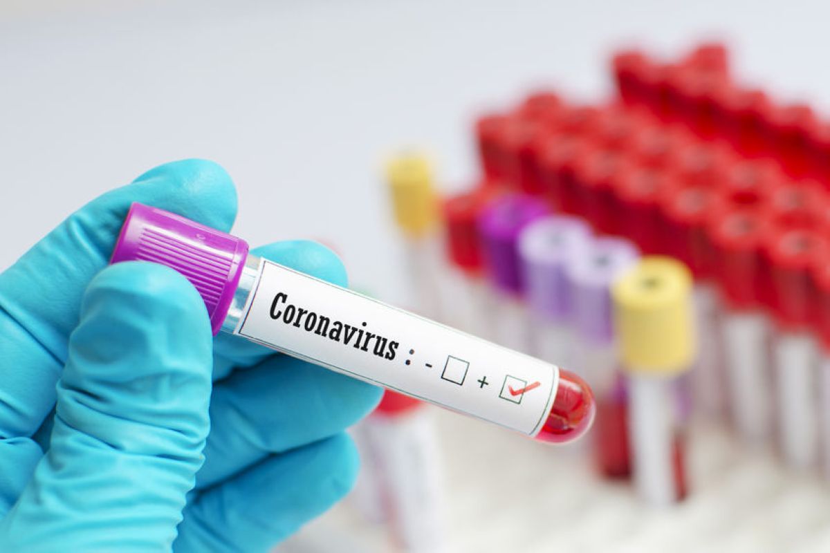 Шымкентте бір тәулікте 60 адамнан коронавирус анықталды