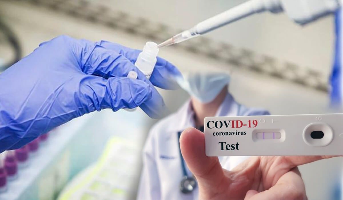 Бір тәулікте коронавирус белгілері жоқ 620 адам анықталды